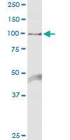 Anti-HELLS Polyclonal Antibody Pair