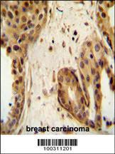 Anti-Stat 2 Rabbit Polyclonal Antibody (AP (Alkaline Phosphatase))