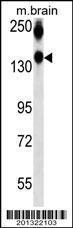 Anti-NCAM1 Mouse Monoclonal Antibody (APC (Allophycocyanin)) [clone: 321CT11.4.4]