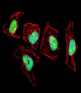 Anti-NFIC Rabbit Polyclonal Antibody (HRP (Horseradish Peroxidase))