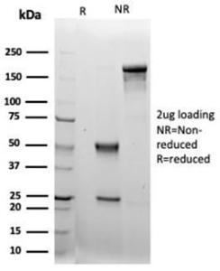 Anti-LRG1 Mouse Monoclonal Antibody [Clone: LRG1/4883]