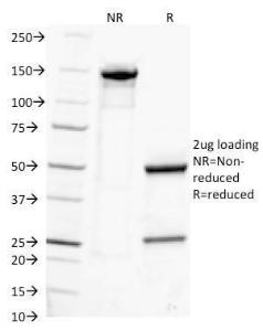 SDS-PAGE analysis of Anti-Human IgG Heavy Chain Antibody [IG217] under non-reduced and reduced conditions; showing intact IgG and intact heavy and light chains, respectively. SDS-PAGE analysis confirms the integrity and purity of the antibody.