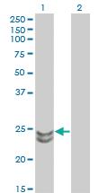 Anti-RAB27A Mouse Monoclonal Antibody [clone: 1G7]