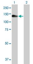 Anti-NLRP3 Rabbit Polyclonal Antibody