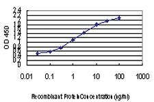 Anti-ZIC4 Mouse Monoclonal Antibody [clone: 4B1]