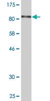 Anti-RHPN2 Mouse Monoclonal Antibody [clone: 1C5]