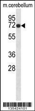 Anti-GLRB Rabbit Polyclonal Antibody (AP (Alkaline Phosphatase))