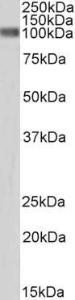 Anti-CTNNB1 Antibody (A83637) (0.3 µg/ml) staining of HeLa lysate (35 µg protein in RIPA buffer). Primary incubation was 1 hour. Detected by chemiluminescence