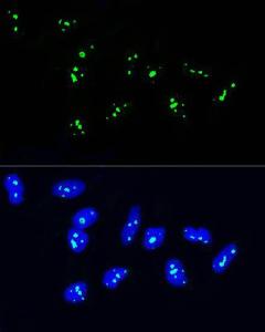 Anti-NOP58 Rabbit Polyclonal Antibody