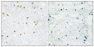 Immunohistochemical analysis of paraffin-embedded human brain tissue using Anti-TRIM24 Antibody. The right hand panel represents a negative control, where the antibody was pre-incubated with the immunising peptide