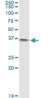 Anti-BLVRA Antibody Pair