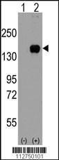 Anti-MAP3K5 Rabbit Polyclonal Antibody (HRP (Horseradish Peroxidase))