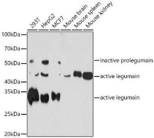 Western blot analysis of extracts of various cell lines, using Anti-Legumain Antibody [ARC1864] (A305372) at 1:1,000 dilution. The secondary antibody was Goat Anti-Rabbit IgG H&L Antibody (HRP) at 1:10,000 dilution.