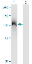 Anti-CBL Mouse Monoclonal Antibody [clone: 6D12]