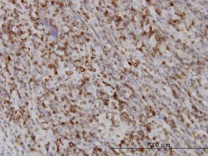 Anti-RAB27A Mouse Monoclonal Antibody [clone: 1G7]