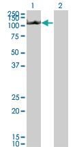 Anti-NLRP3 Mouse Monoclonal Antibody [clone: 3B1]