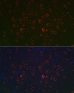 Immunofluorescence analysis of rat brain using Anti-REEP2 Antibody (A93314) at a dilution of 1:100 (40X lens). DAPI was used to stain the cell nuclei (blue)