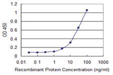 Anti-SIRT6 Mouse Monoclonal Antibody [clone: 1D8]