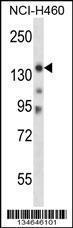 Anti-MYO3B Rabbit Polyclonal Antibody