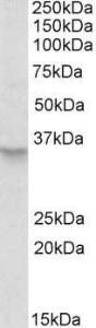 Anti-PXMP3 Antibody (A83639) (0.5 µg/ml) staining of HeLa lysate (35 µg protein in RIPA buffer). Primary incubation was 1 hour. Detected by chemiluminescence