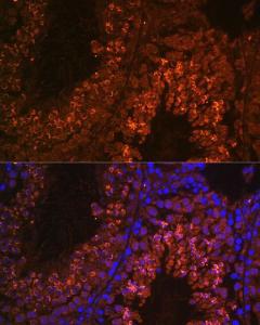 Immunofluorescence analysis of mouse testis using Anti-UBQLN3 Antibody (A309177) at a dilution of 1:100 DAPI was used to stain the cell nuclei (blue)