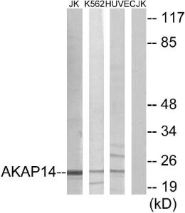 Western blot analysis of lysates from Jurkat, K56 and HUVEC cells using Anti-AKAP14 Antibody. The right hand lane represents a negative control, where the antibody is blocked by the immunising peptide