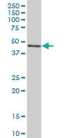 Anti-SERPINH1 Mouse Polyclonal Antibody