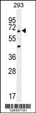 Anti-ANKRD34B Rabbit Polyclonal Antibody