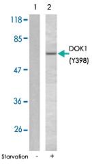 Anti-DOK1 Rabbit Polyclonal Antibody