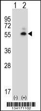 Anti-CAMK2D Rabbit Polyclonal Antibody (FITC (Fluorescein Isothiocyanate))