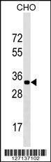 Anti-GPATCH11 Rabbit Polyclonal Antibody