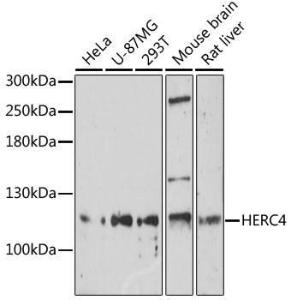 Western blot analysis of extracts of various cell lines, using Anti-HERC4 Antibody (A309178) at 1:1,000 dilution. The secondary antibody was Goat Anti-Rabbit IgG H&L Antibody (HRP) at 1:10,000 dilution.