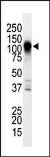 Anti-MAP3K6 Rabbit Polyclonal Antibody (FITC (Fluorescein))