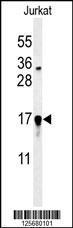 Anti-GLRX5 Rabbit Polyclonal Antibody (APC (Allophycocyanin))