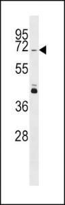 Anti-PINK1 Rabbit Polyclonal Antibody