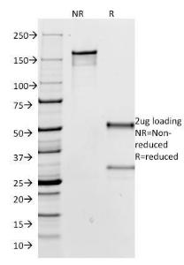 SDS-PAGE analysis of Anti-Human IgG Heavy Chain Antibody [IG266] under non-reduced and reduced conditions; showing intact IgG and intact heavy and light chains, respectively. SDS-PAGE analysis confirms the integrity and purity of the antibody.