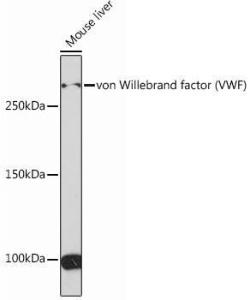 Western blot analysis of extracts of Mouse liver, using Anti-Von Willebrand Factor Antibody [ARC0716] (A305374) at 1:1,000 dilution