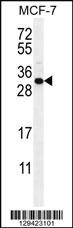 Anti-C1QL4 Rabbit Polyclonal Antibody