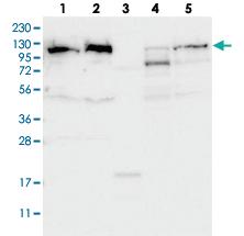 Anti-IARS2 Rabbit Polyclonal Antibody