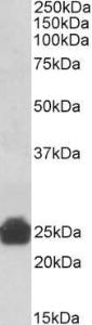 Anti-Gsta5 Antibody (A83642) (0.3 µg/ml) staining of Rat Liver lysate (35 µg protein in RIPA buffer). Primary incubation was 1 hour. Detected by chemilu minescence