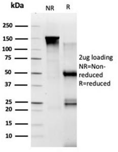 SDS-PAGE analysis of Anti-TADA1 Antibody [PCRP-TADA1-1C9] under non-reduced and reduced conditions; showing intact IgG and intact heavy and light chains, respectively. SDS-PAGE analysis confirms the integrity and purity of the antibody