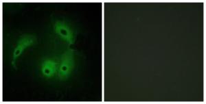 Immunofluorescence analysis of HeLa cells using Anti-AKAP14 Antibody. The right hand panel represents a negative control, where the antibody was pre-incubated with the immunising peptide