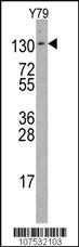 Anti-ABL2 Rabbit Polyclonal Antibody