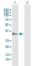 Anti-TIRAP Rabbit Polyclonal Antibody