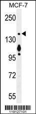 Anti-MYO6 Rabbit Polyclonal Antibody (Biotin)