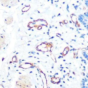 Immunohistochemistry analysis of paraffin-embedded human esophageal using Anti-Von Willebrand Factor Antibody [ARC0716] (A305374) at a dilution of 1:100 (40X lens). Perform microwave antigen retrieval with 10 mM PBS buffer pH 7.2 before commencing with IHC staining protocol