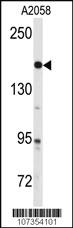 Anti-ABL1 Rabbit Polyclonal Antibody