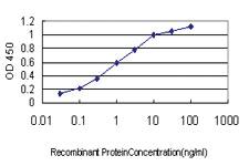 Anti-RAB27A Mouse Monoclonal Antibody [clone: 1G7]