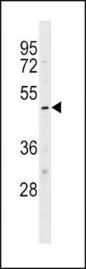 Anti-KCNJ10 Rabbit Polyclonal Antibody (FITC (Fluorescein Isothiocyanate))