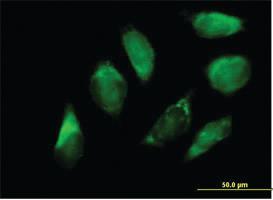 Anti-SERPINH1 Mouse Polyclonal Antibody